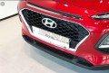Viền xi mặt calang Hyundai Kona 2019